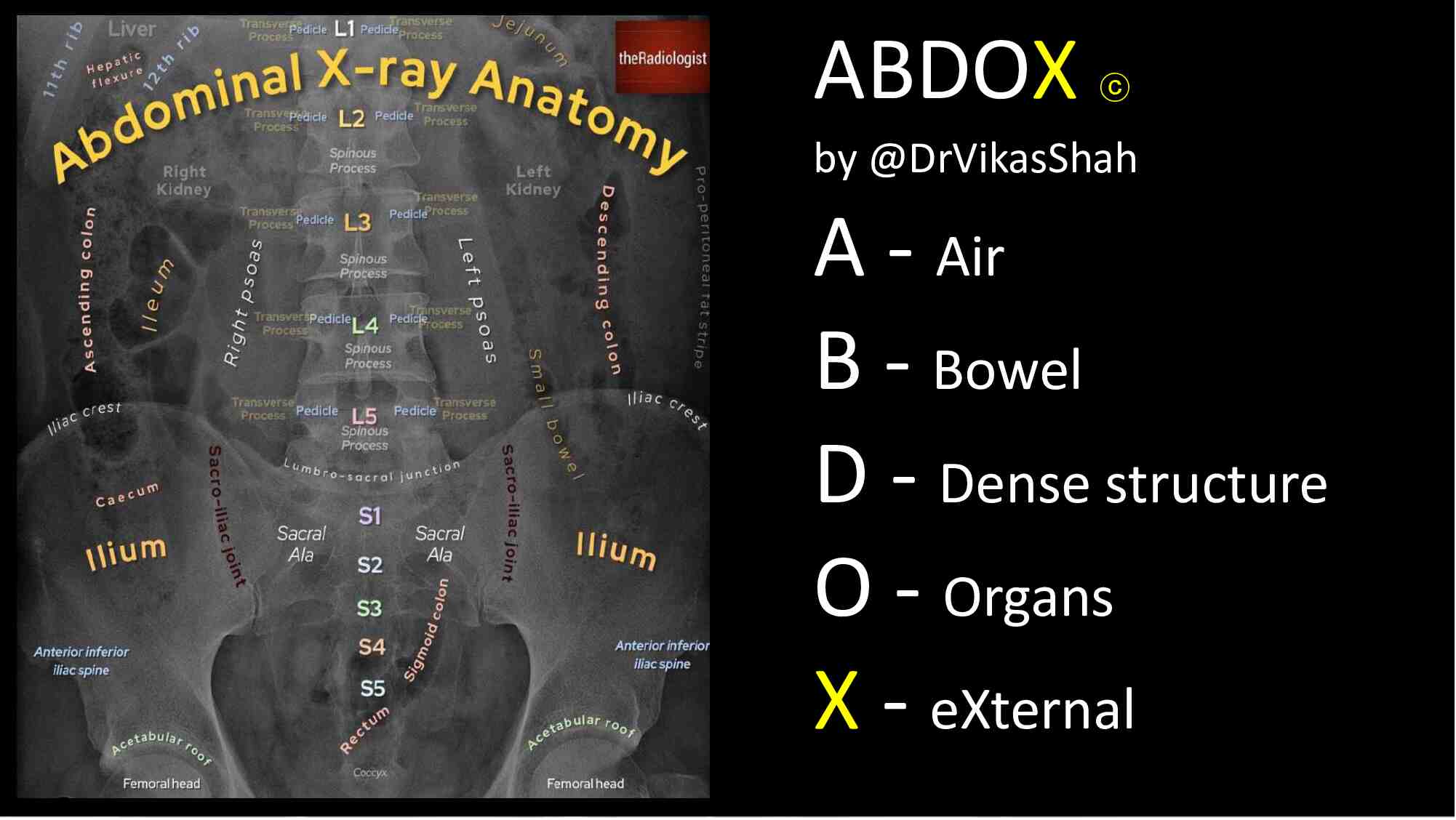 [day-1]-pemilihan-modalitas-pencitraan-pada-kasus-gawat-abdomen-724